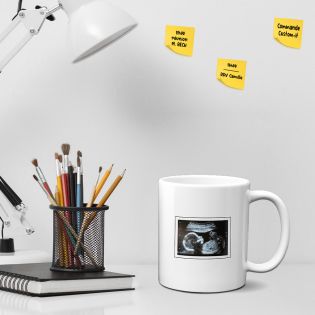 Personalized white ceramic mug with ultrasound photo · Future Papa Poule