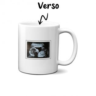 Personalized white ceramic mug with ultrasound photo · Future Papa Poule