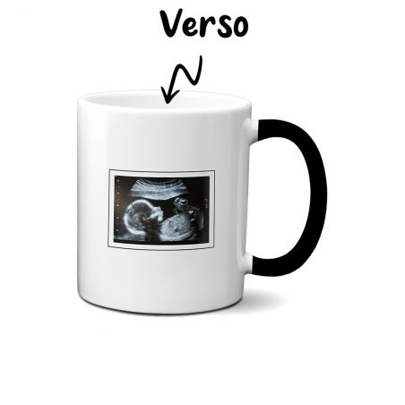 Customizable thermoreactive surprise magic mug with ultrasound photo · Pregnancy announcement gift